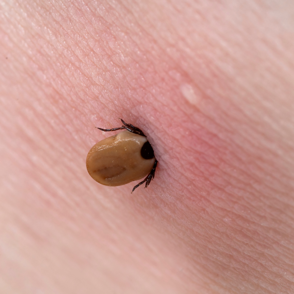Photo – Exterminatek (3)